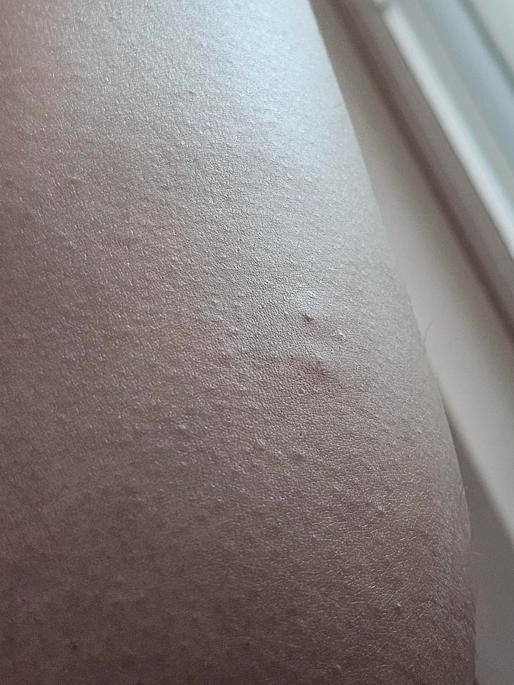2번 째 사진