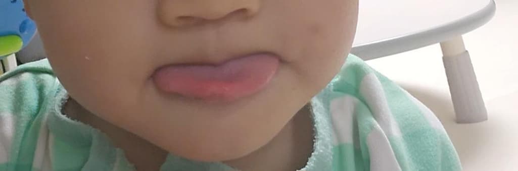 2번 째 사진