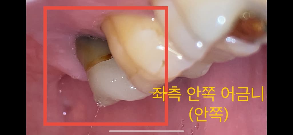 3번 째 사진