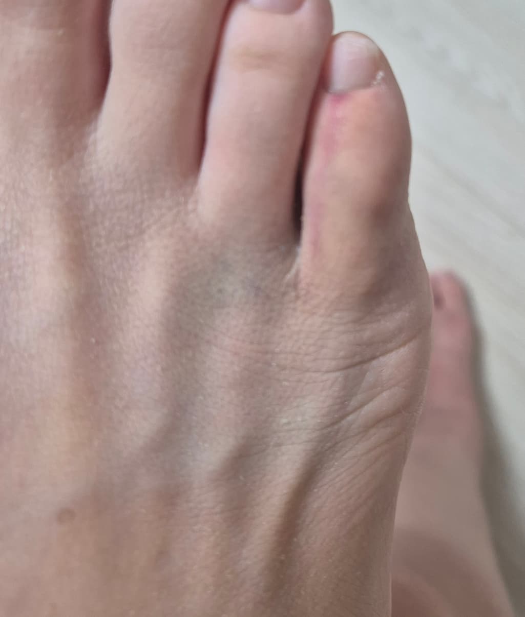 6번 째 사진