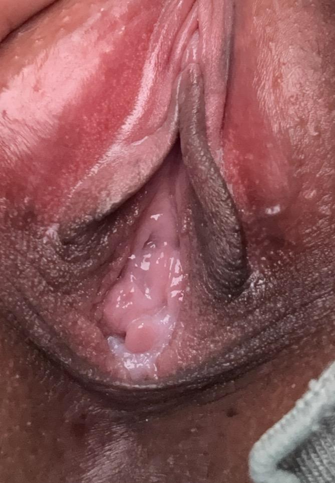 3번 째 사진