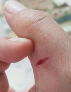 2번 째 사진