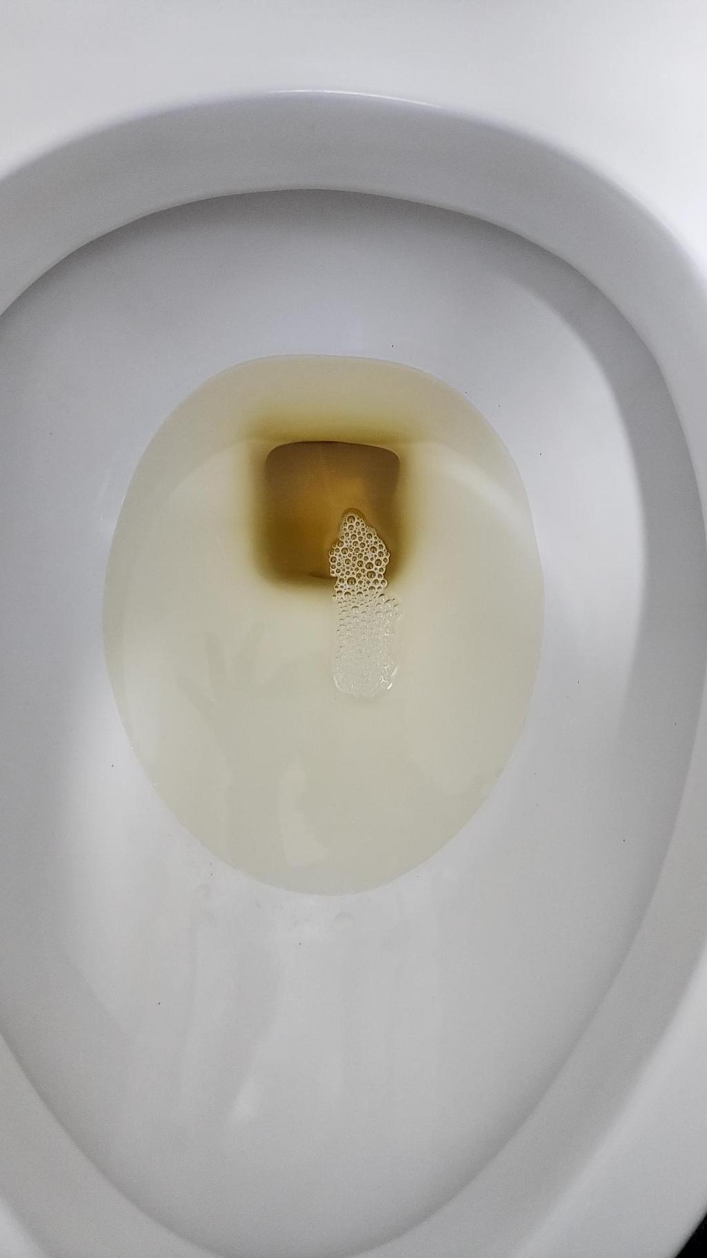 2번 째 사진