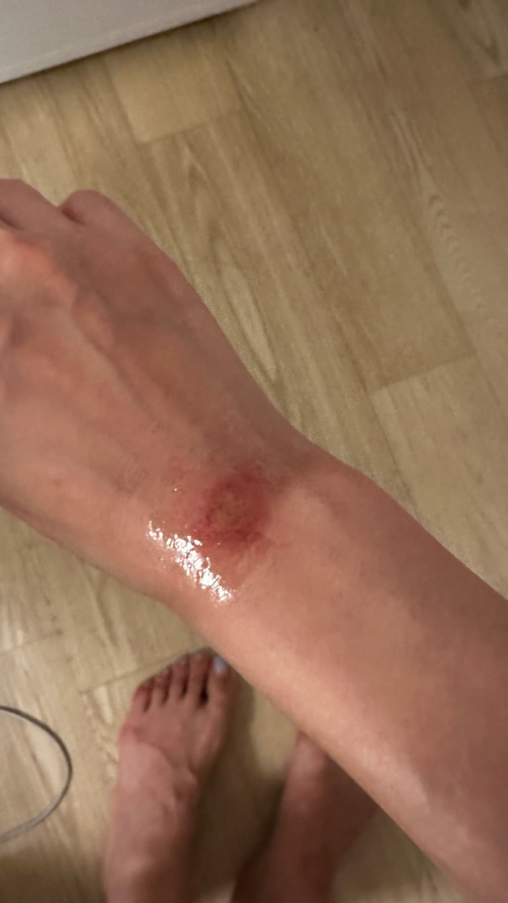 1번 째 사진