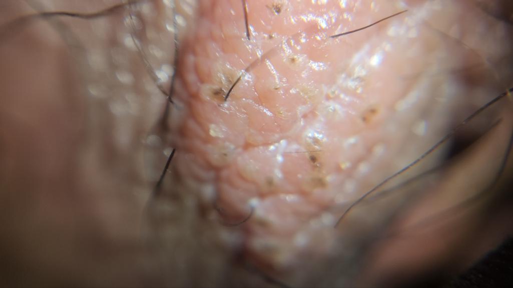 10번 째 사진