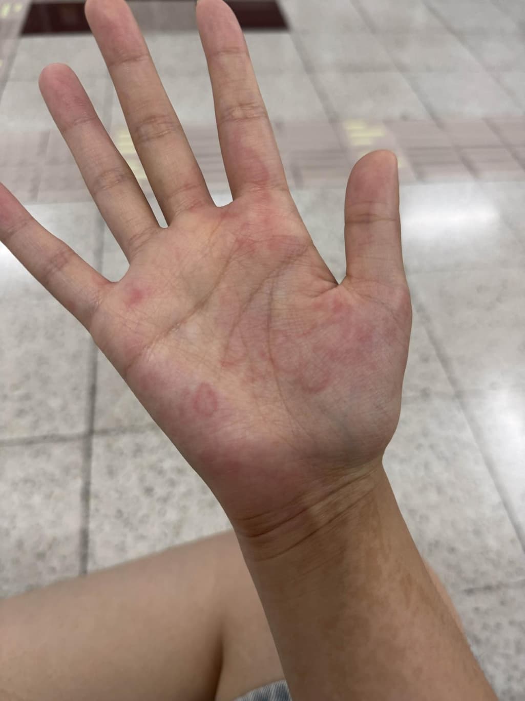 2번 째 사진