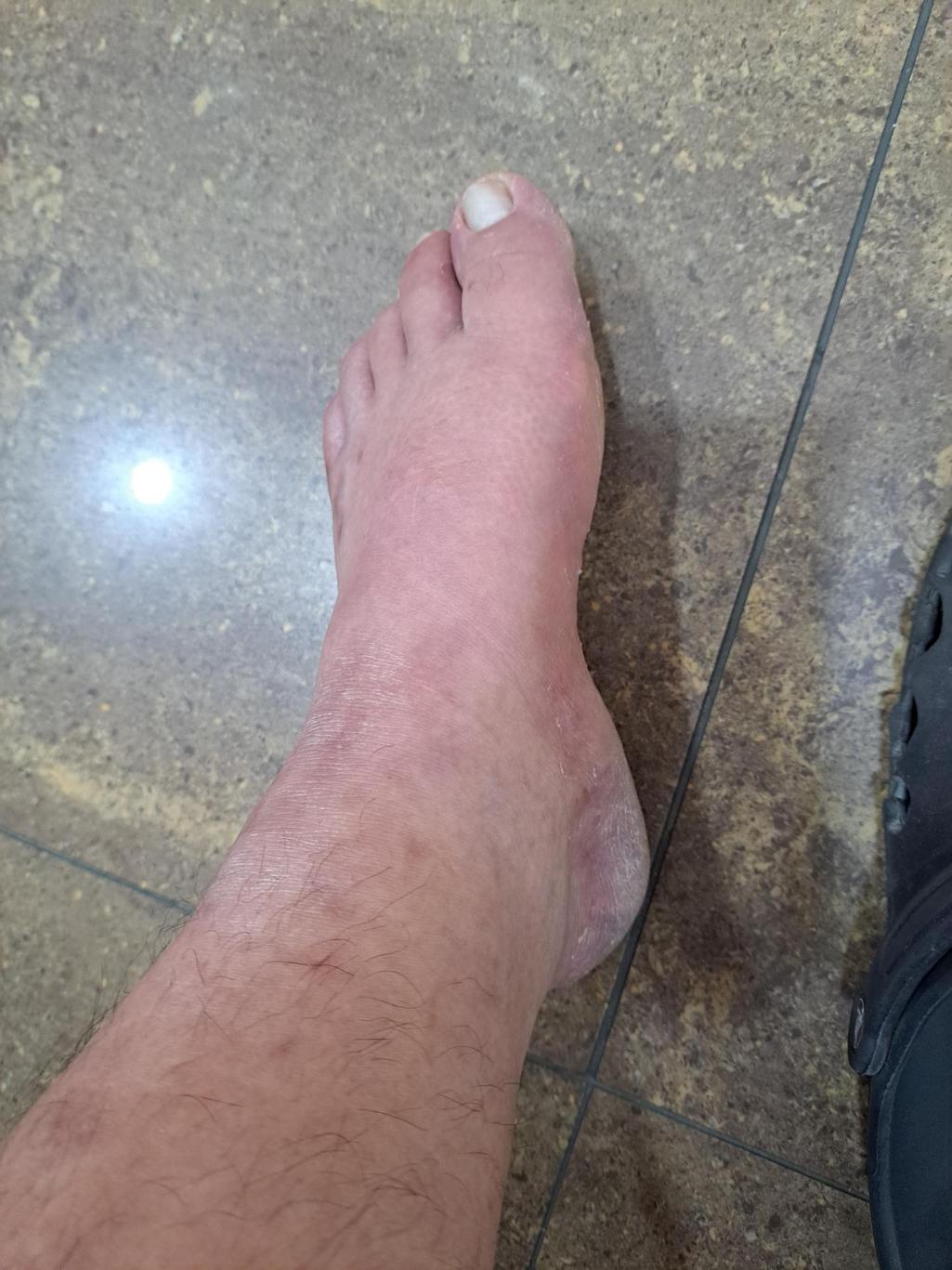 2번 째 사진
