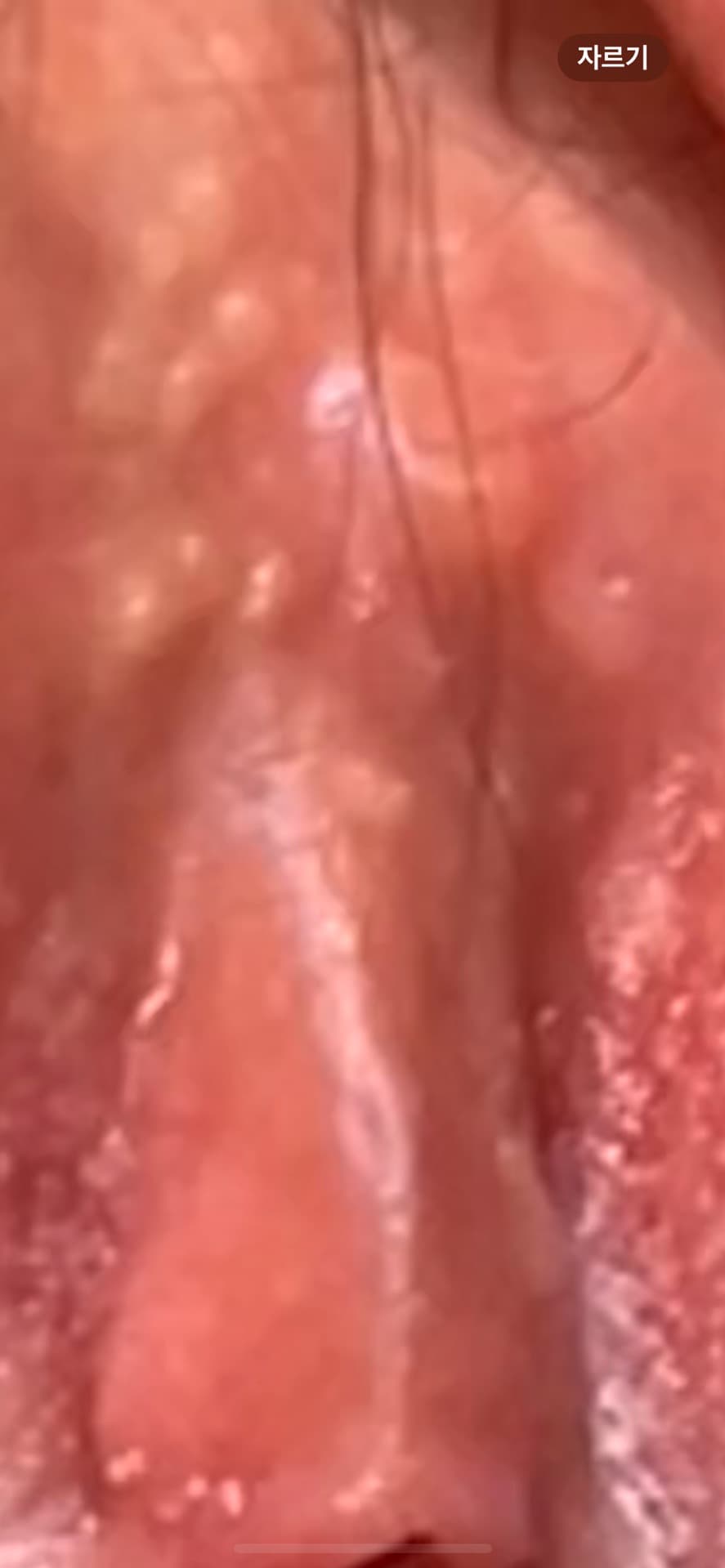 2번 째 사진