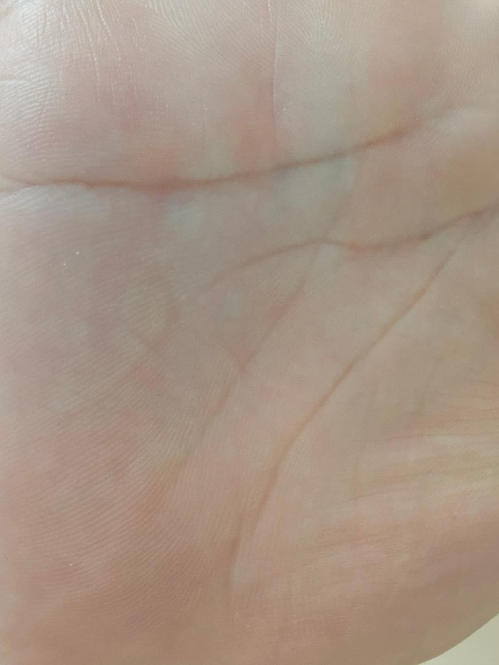 2번 째 사진