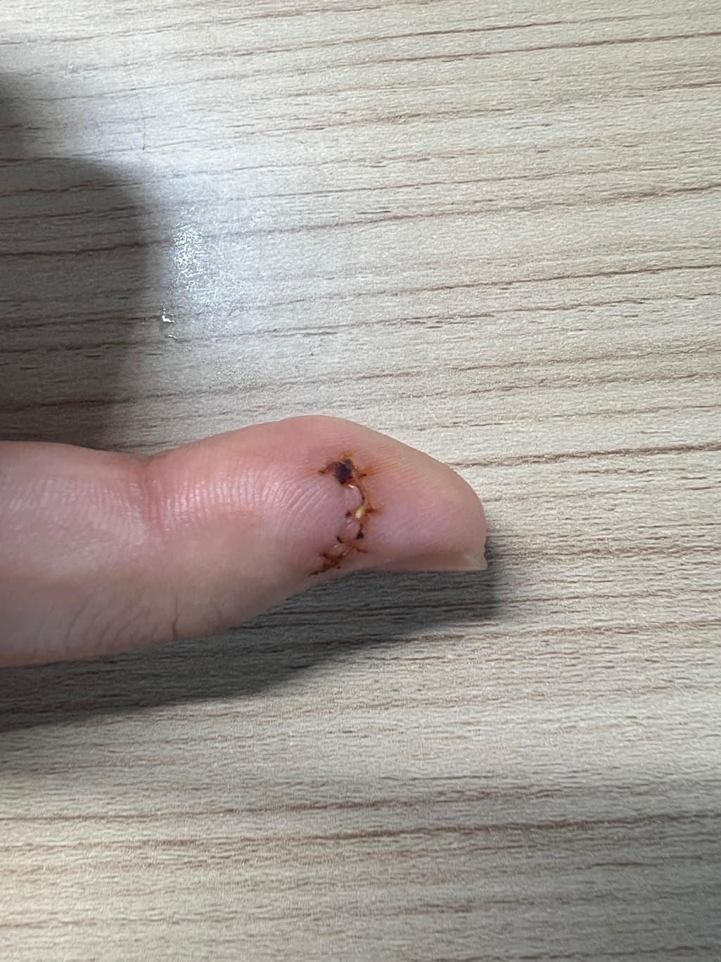 1번 째 사진