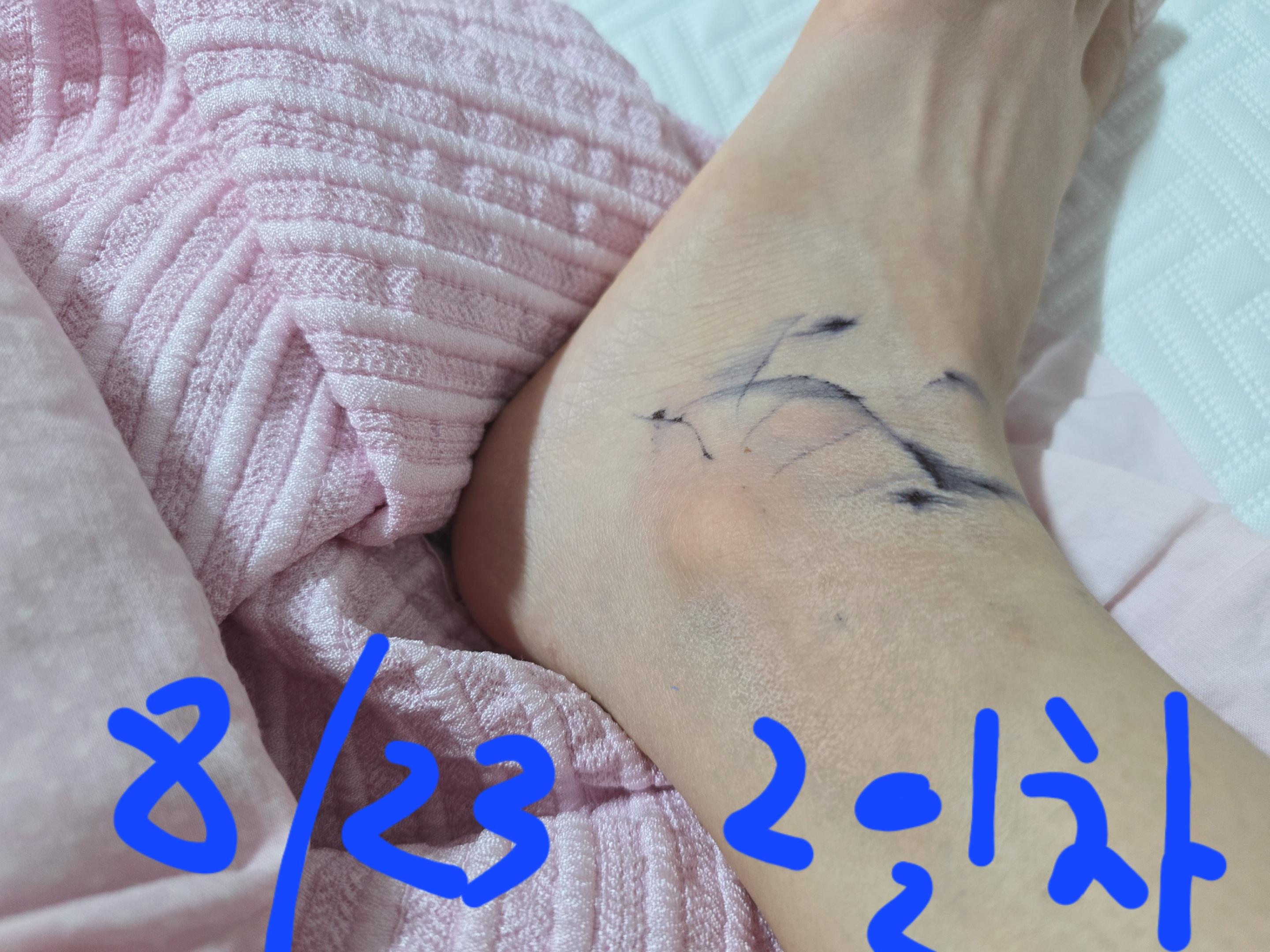 2번 째 사진
