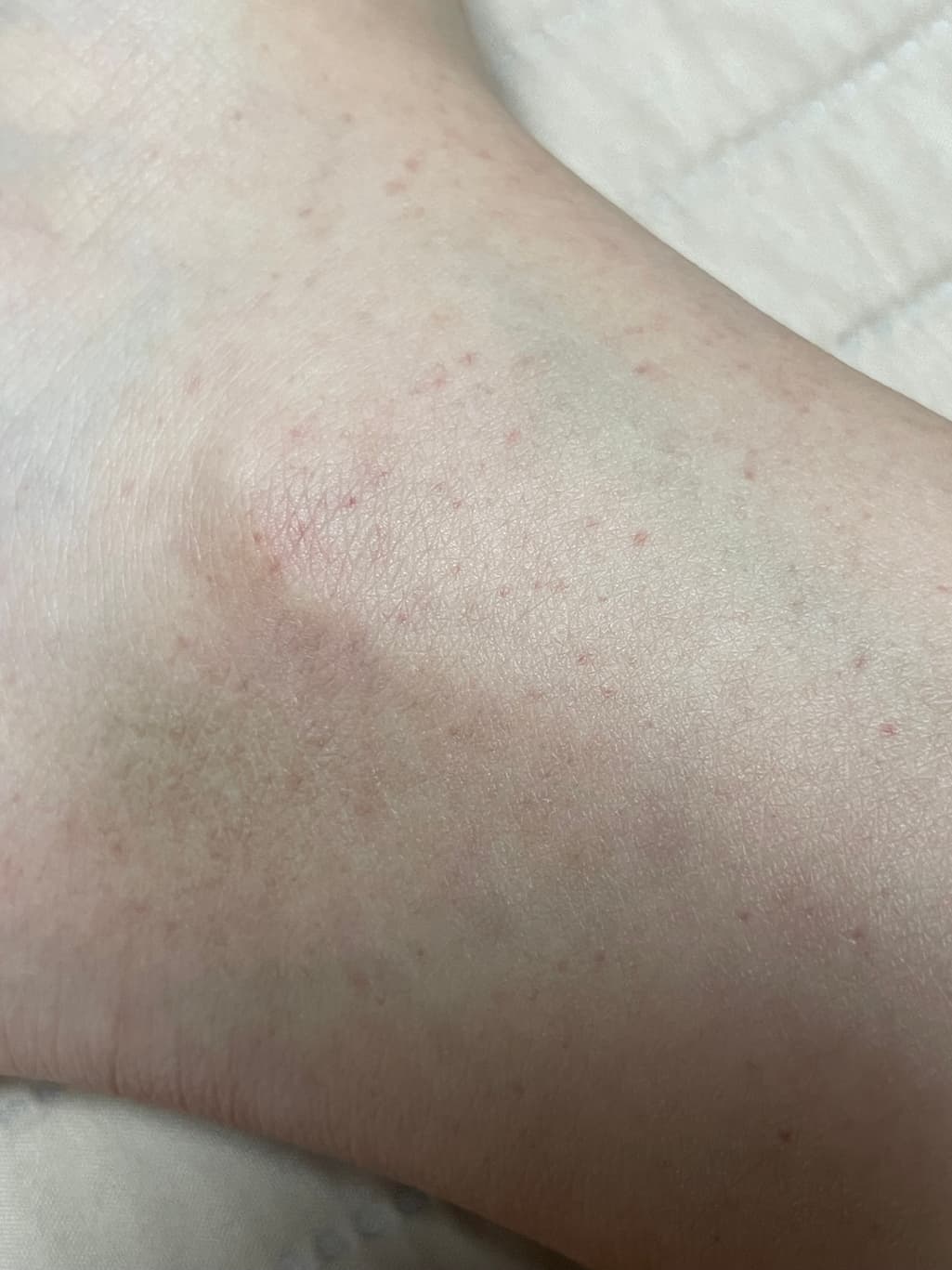 3번 째 사진