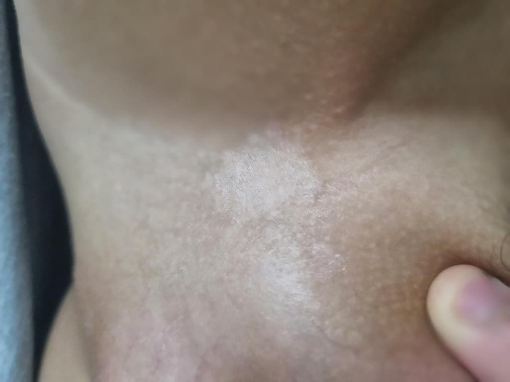 2번 째 사진