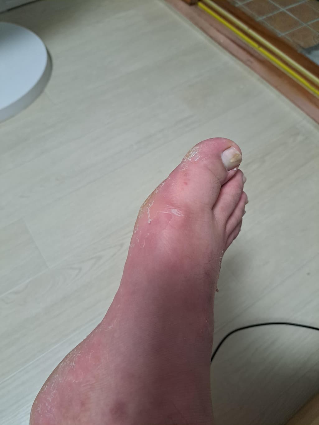 2번 째 사진