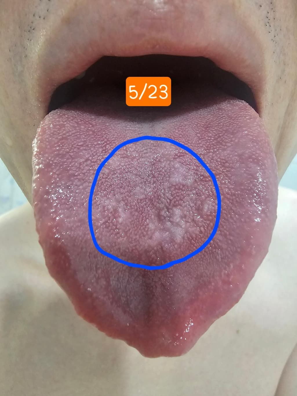 1번 째 사진