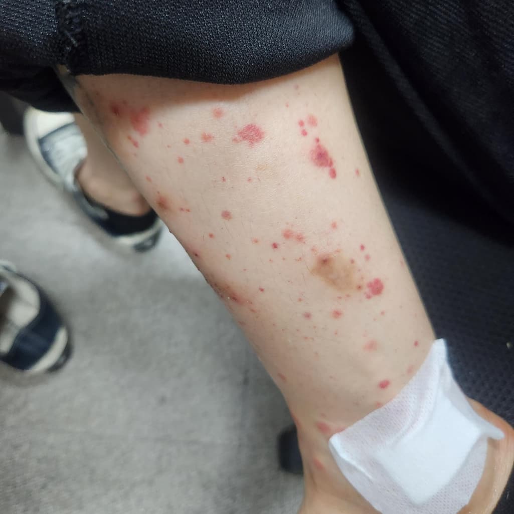 1번 째 사진