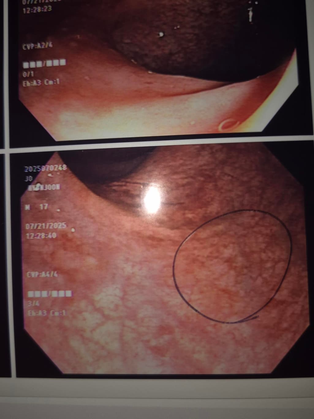 2번 째 사진