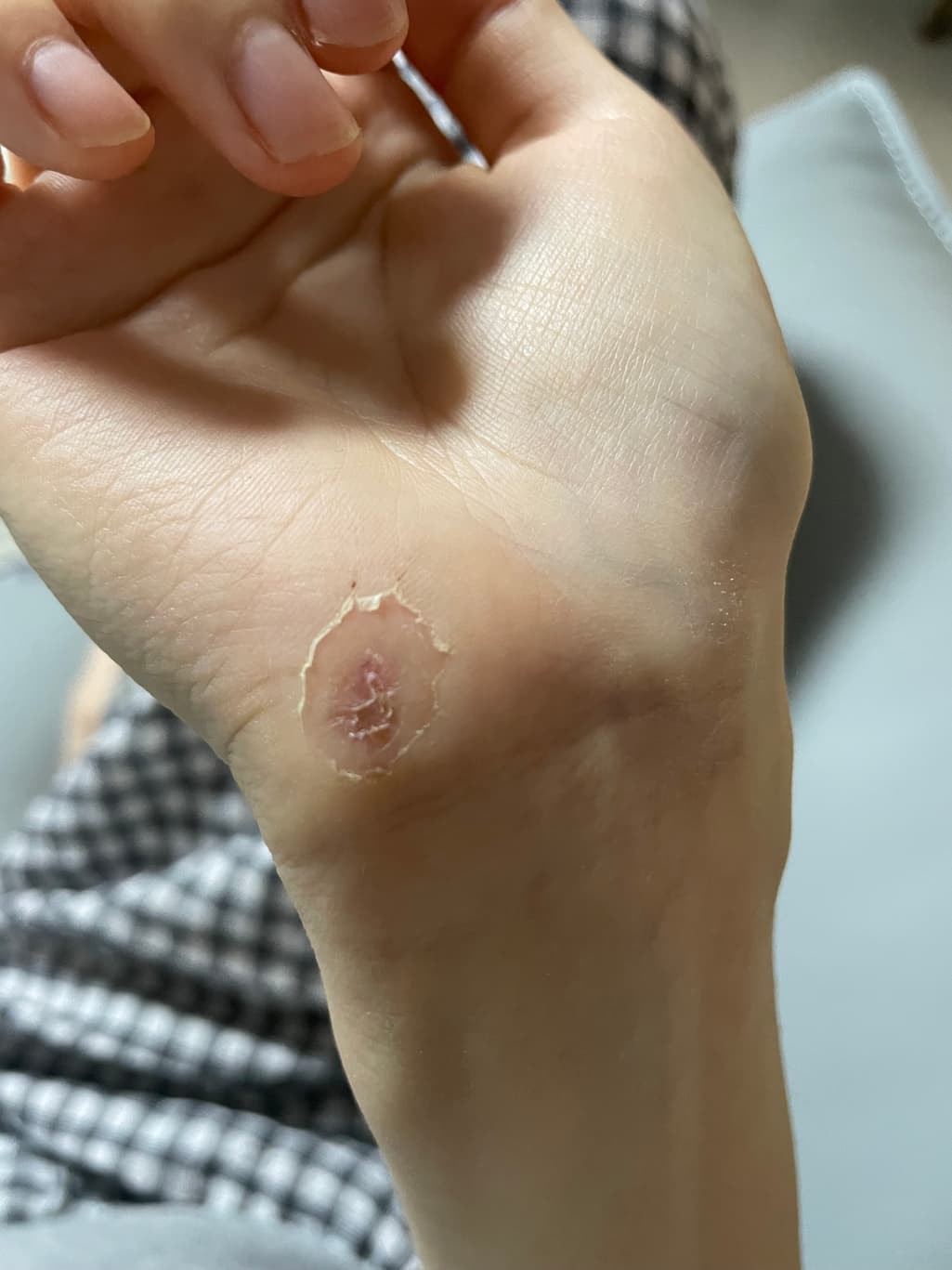 2번 째 사진