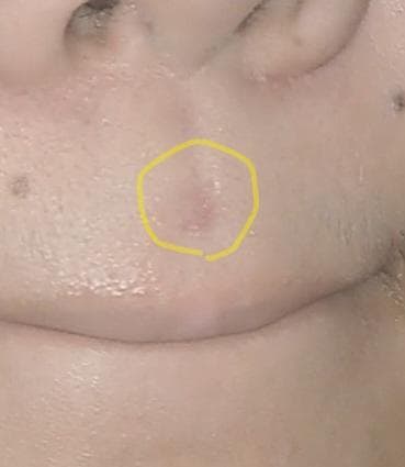 2번 째 사진