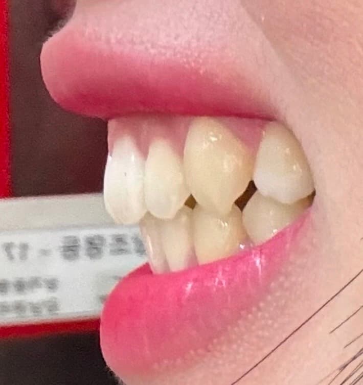 4번 째 사진