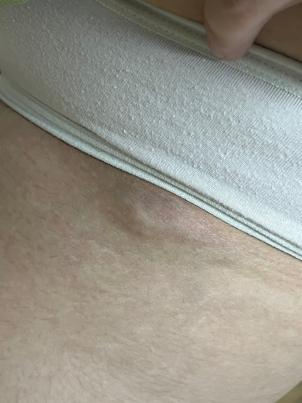 2번 째 사진