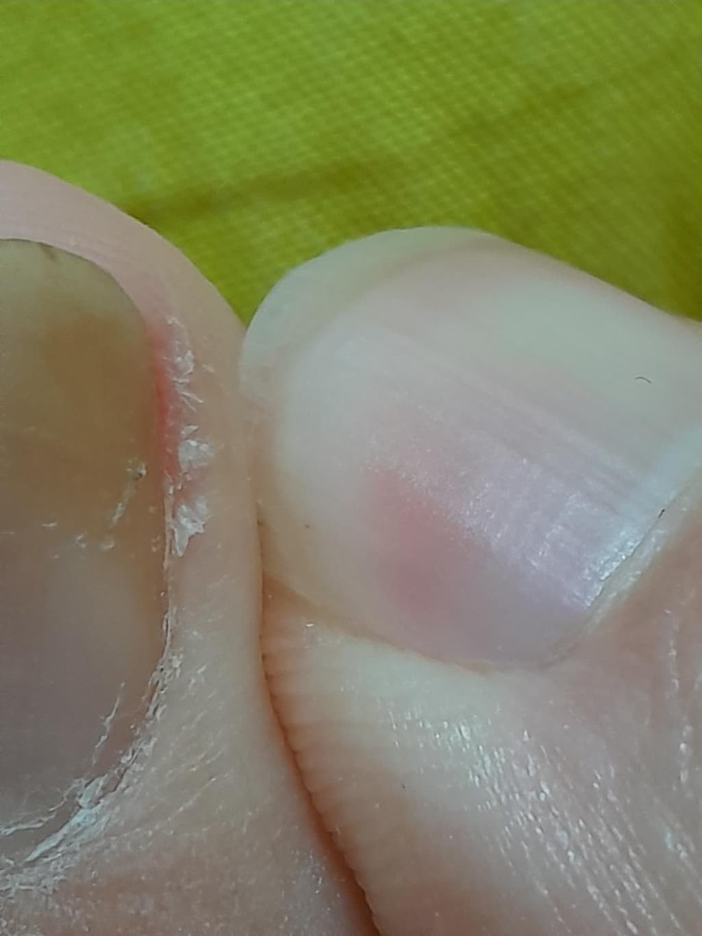 2번 째 사진