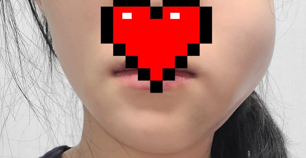 2번 째 사진