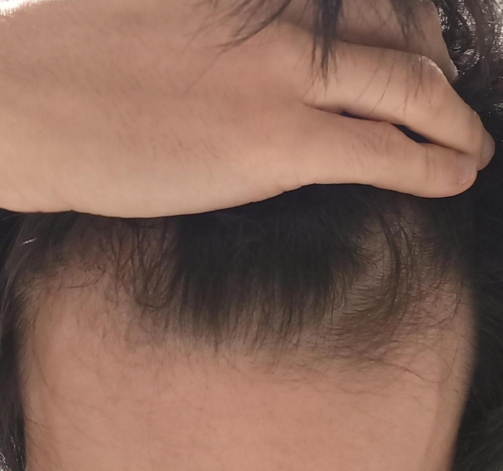3번 째 사진