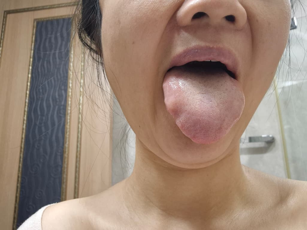 3번 째 사진