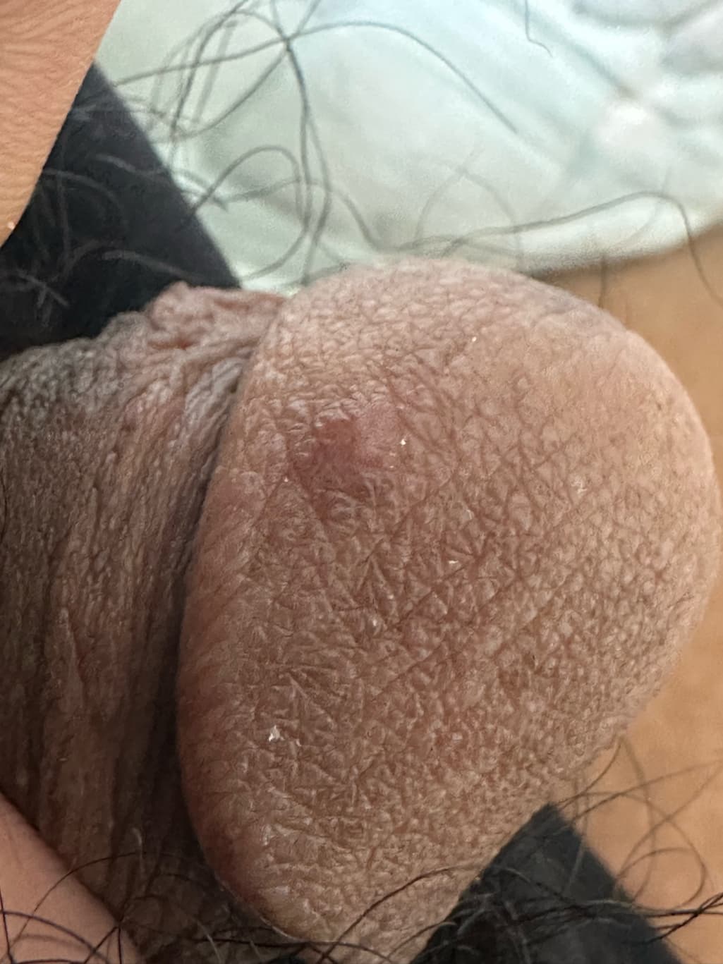 2번 째 사진