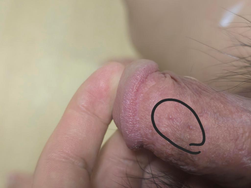 3번 째 사진