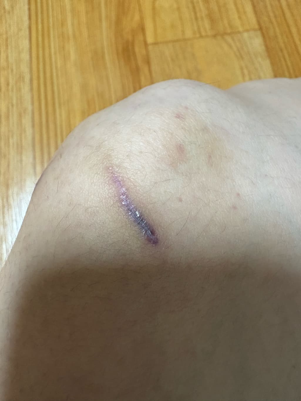 1번 째 사진