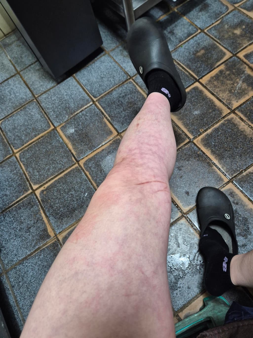2번 째 사진