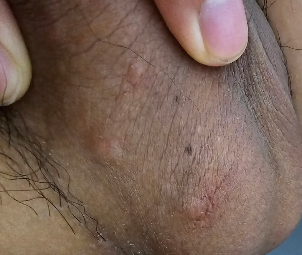 2번 째 사진
