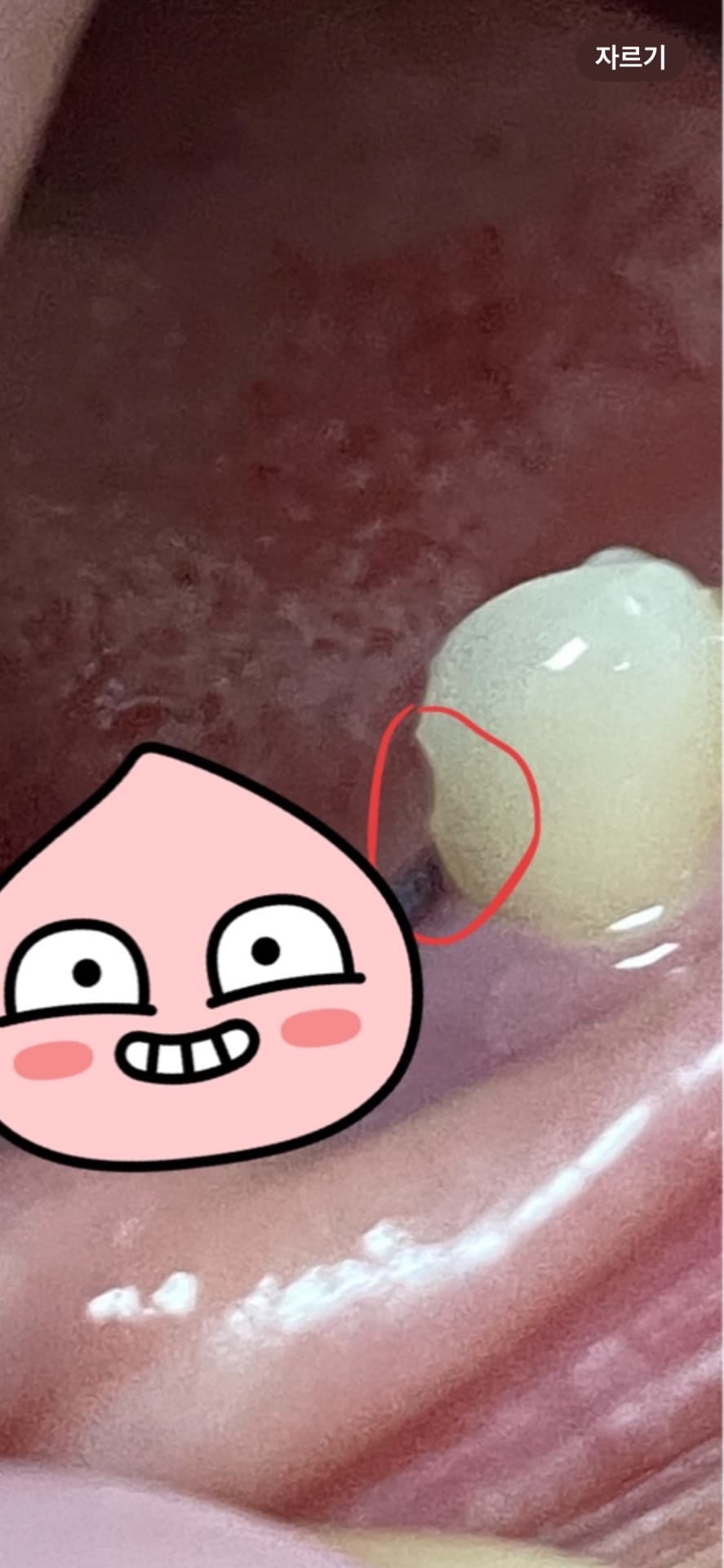 2번 째 사진