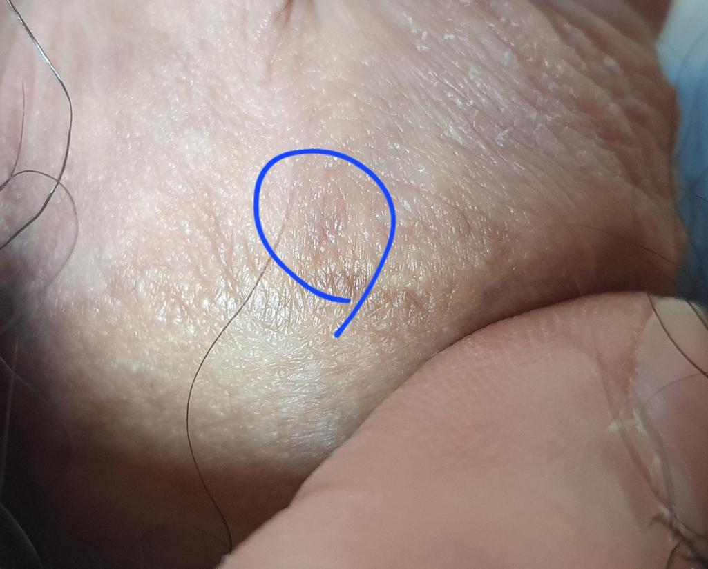 3번 째 사진