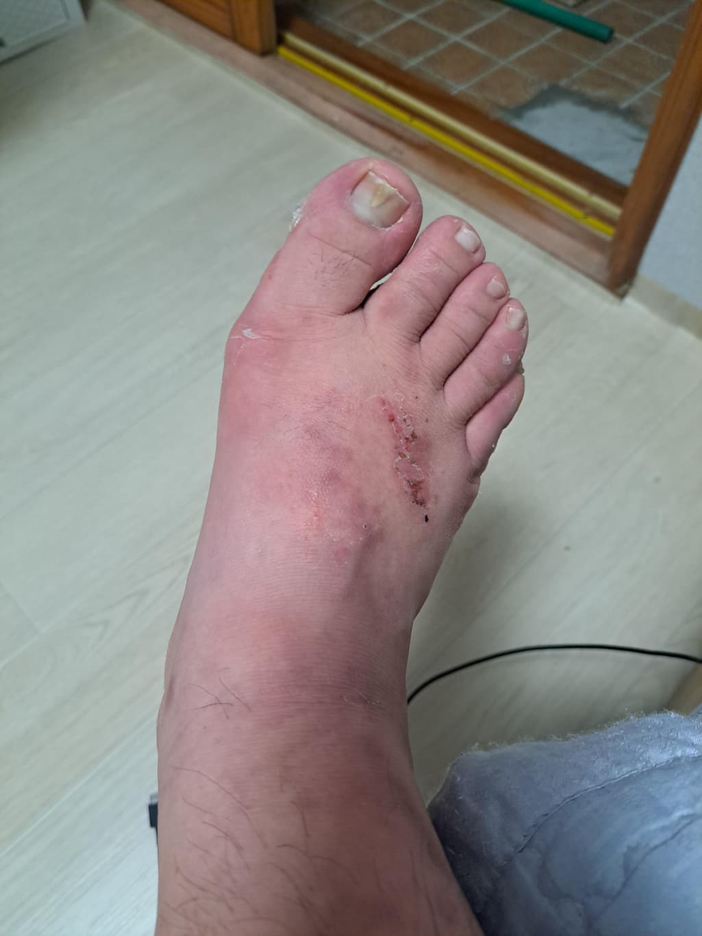 1번 째 사진