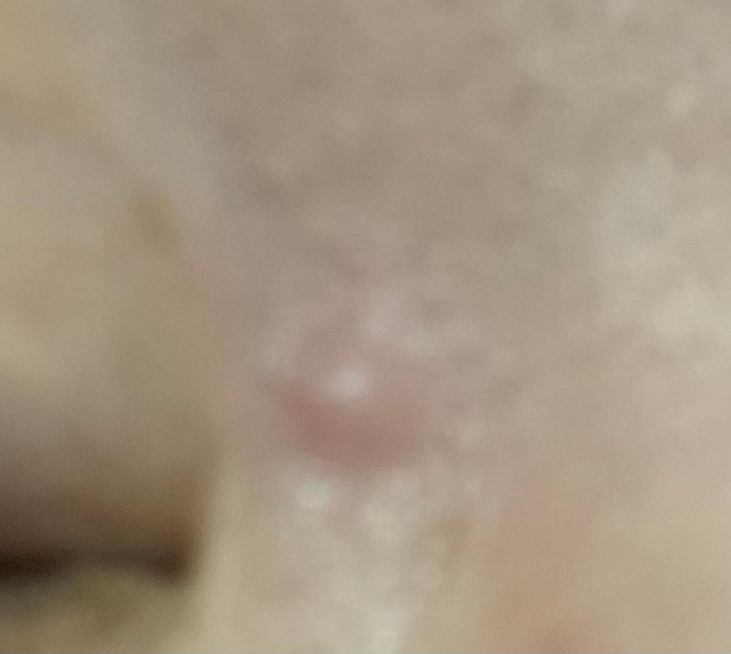 2번 째 사진