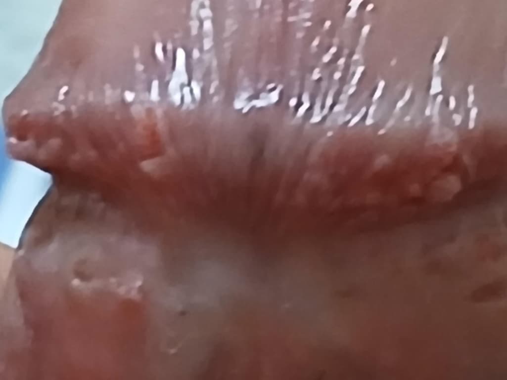 2번 째 사진