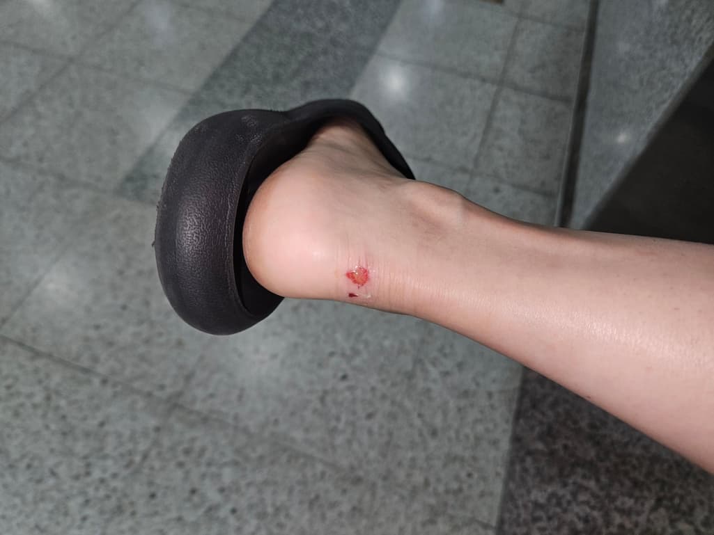 2번 째 사진