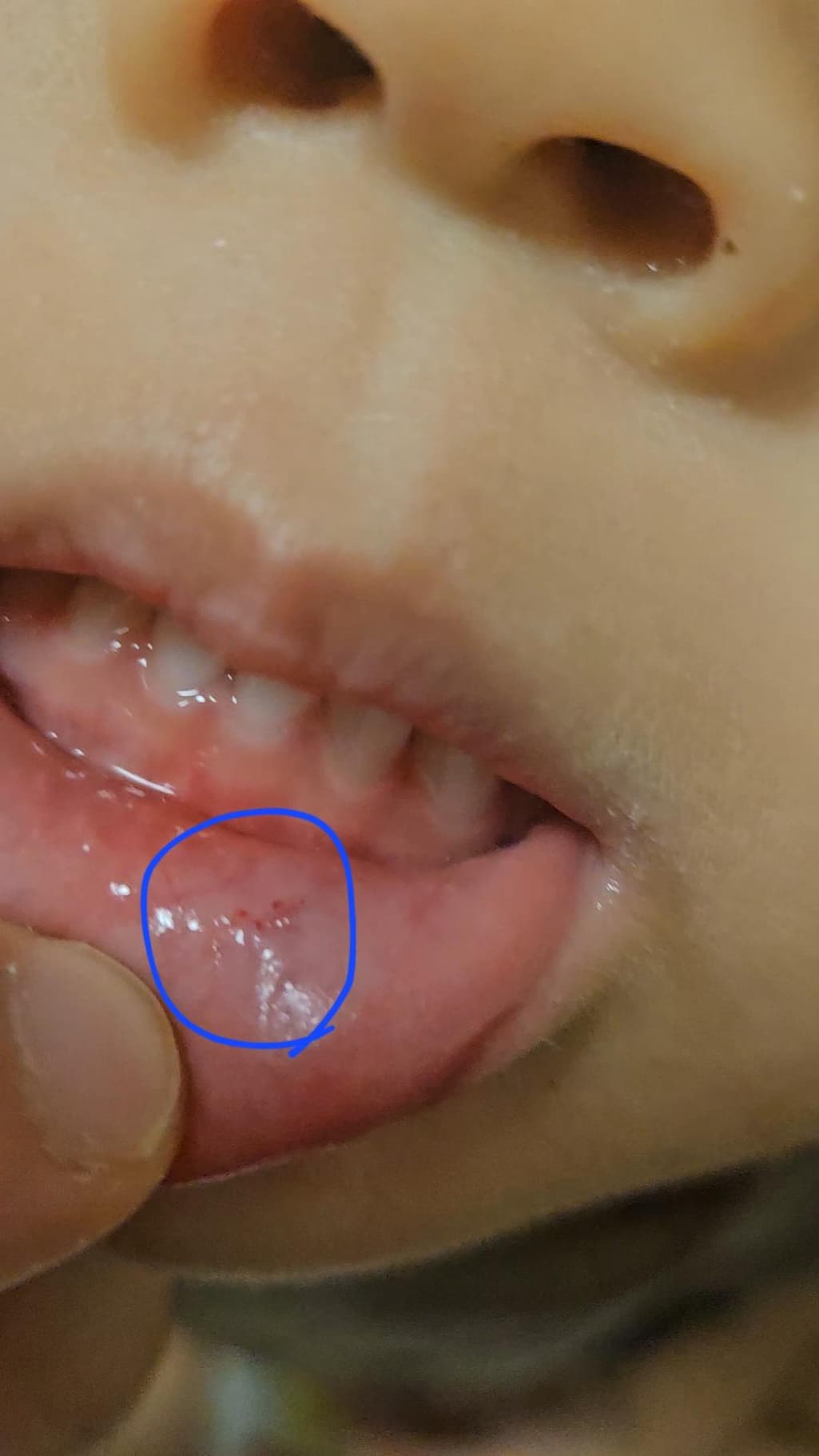 2번 째 사진