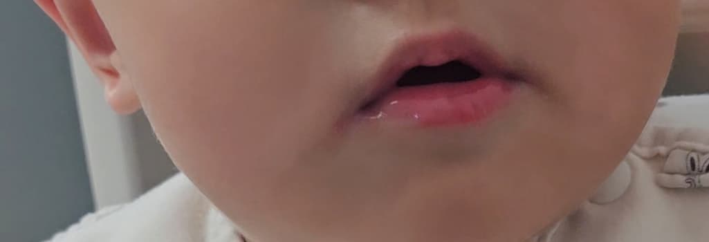 2번 째 사진