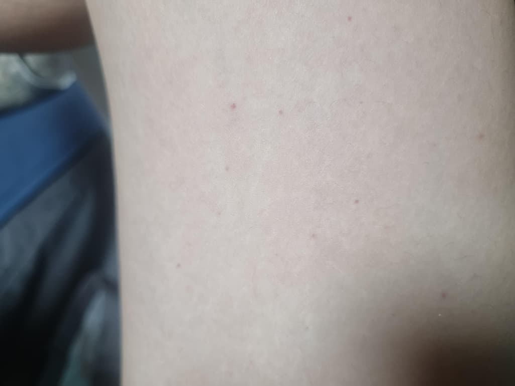 2번 째 사진