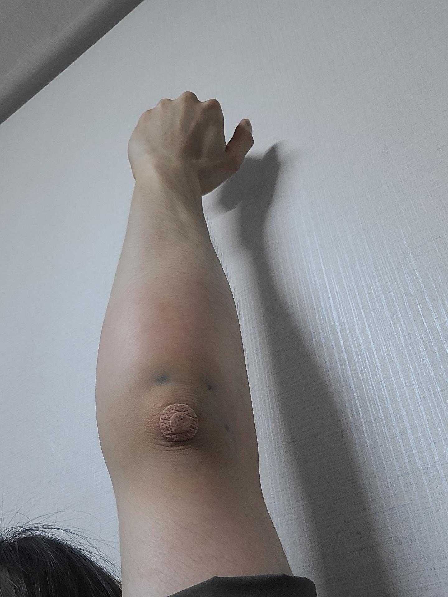3번 째 사진