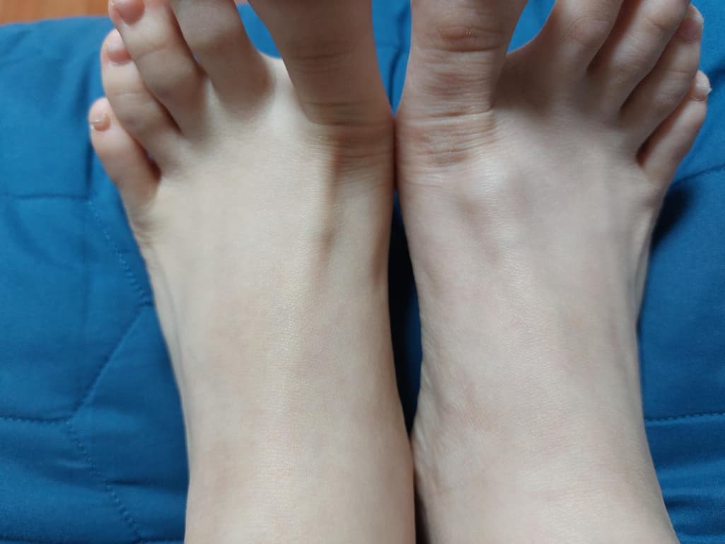 2번 째 사진