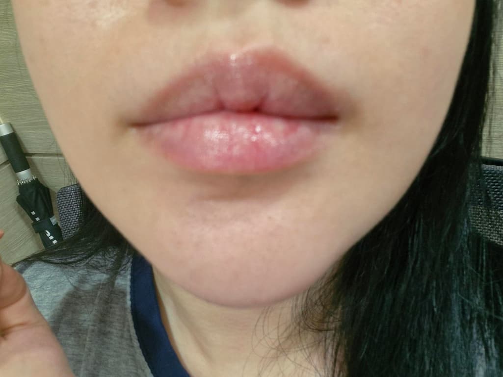 2번 째 사진