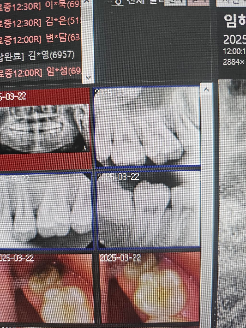 10번 째 사진
