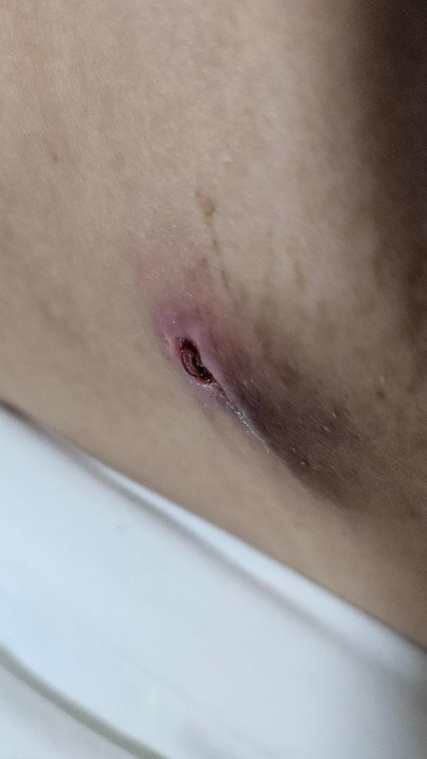 1번 째 사진