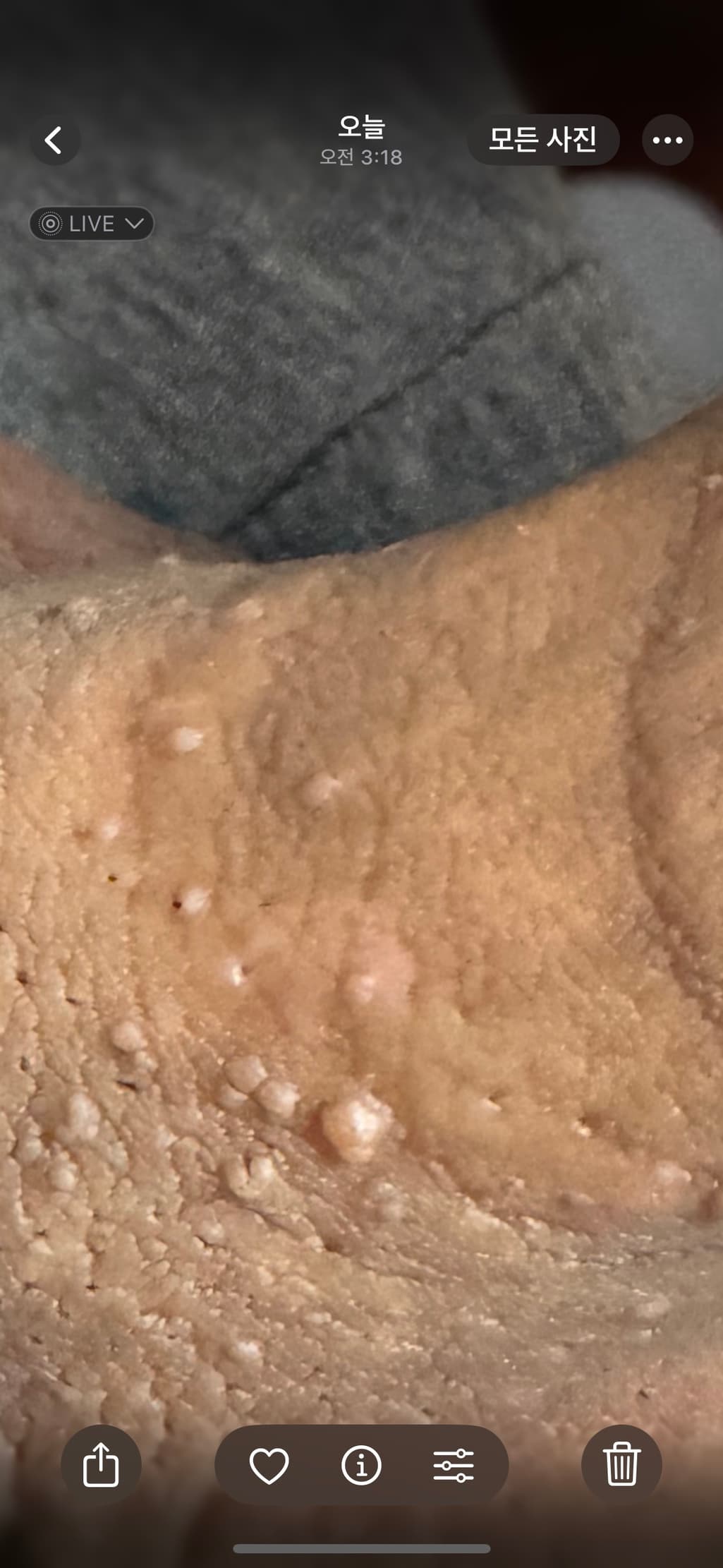 3번 째 사진