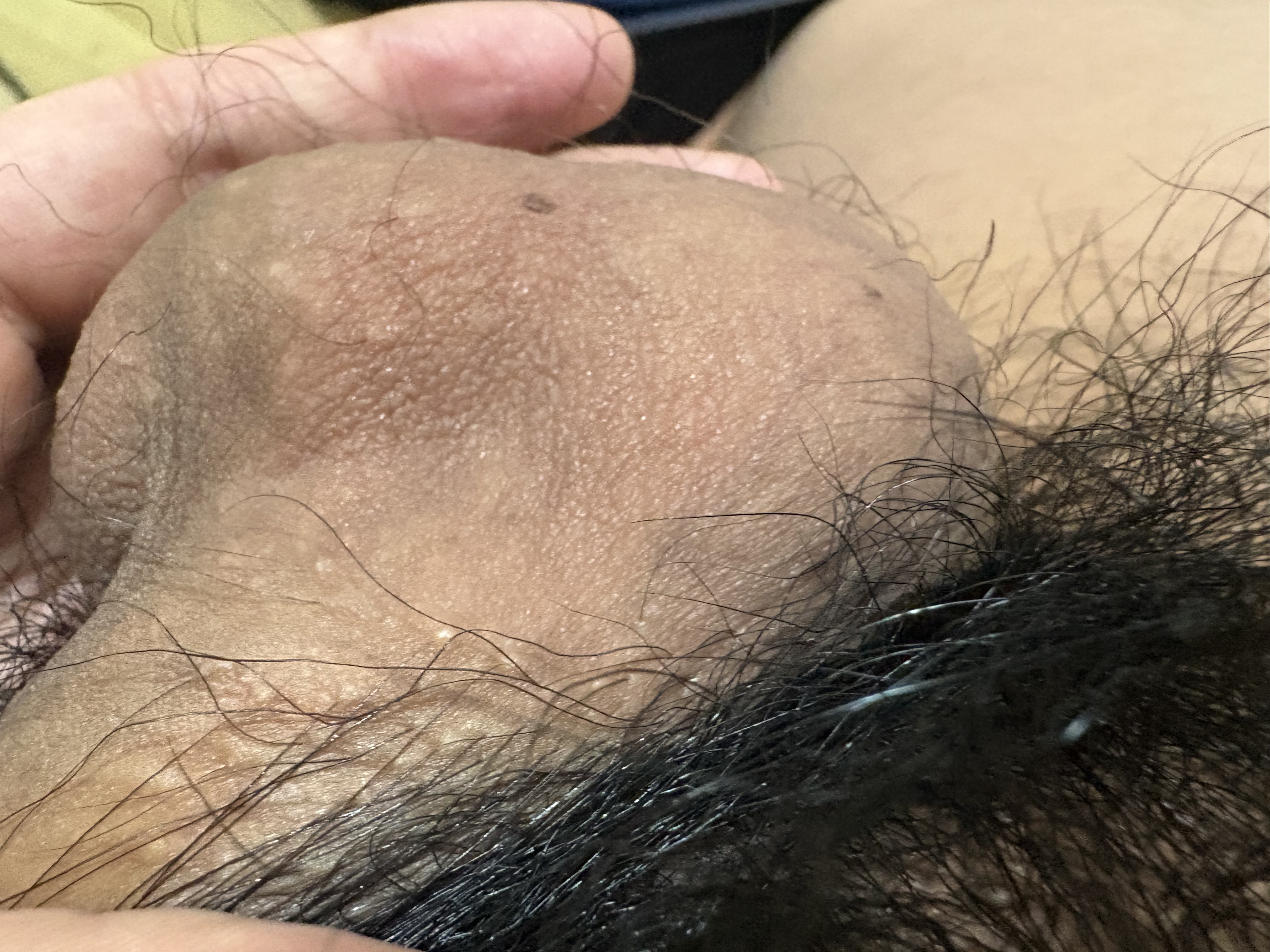 3번 째 사진